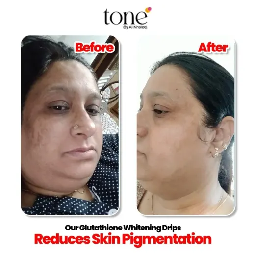 Tone by AlKhaleej clinic photo
