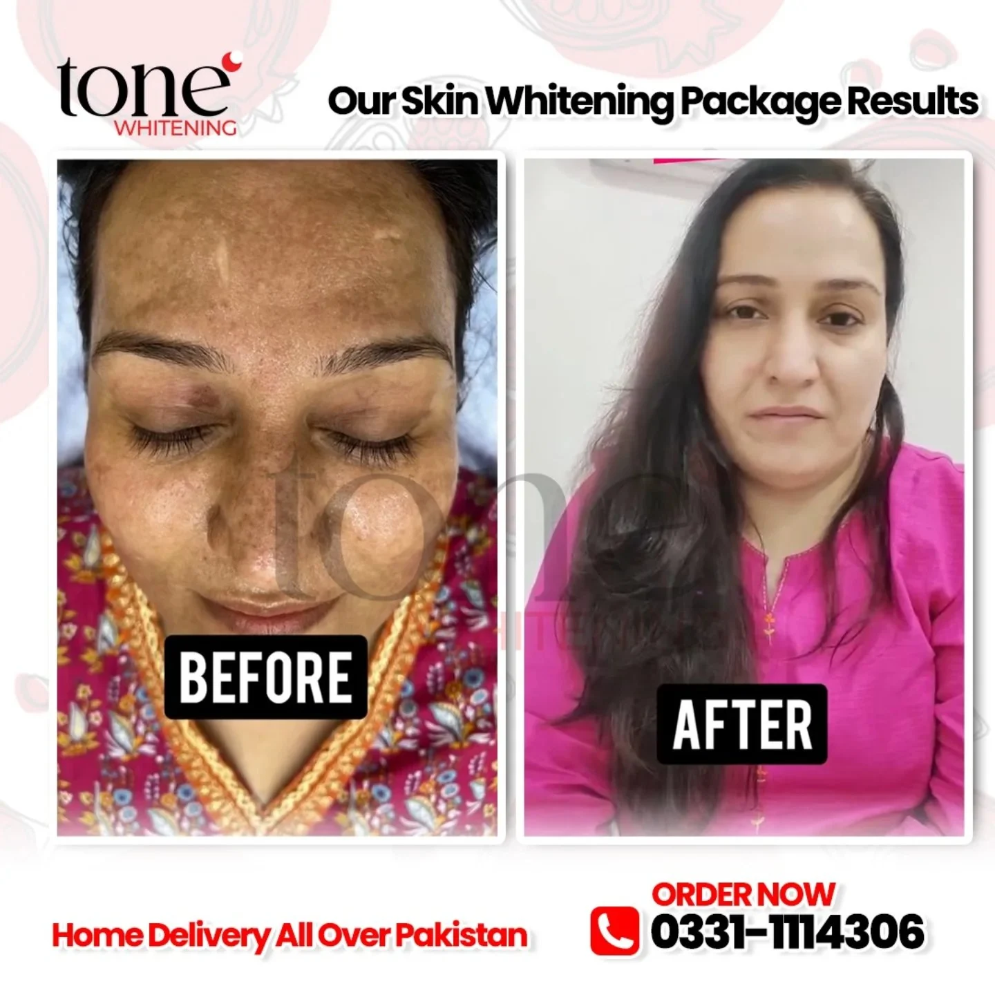 Tone by AlKhaleej clinic photo